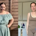 Mounjaro Before and After 1 Month