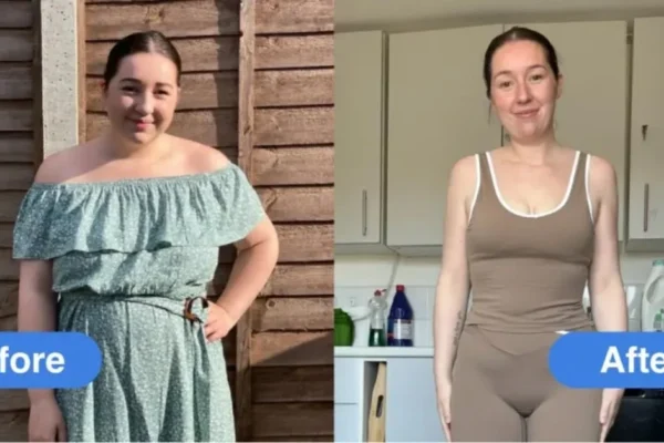 Mounjaro Before and After 1 Month