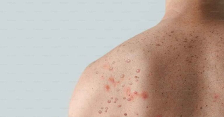 itchy skin